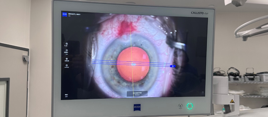 Screen in operating theatre showing eye surgery